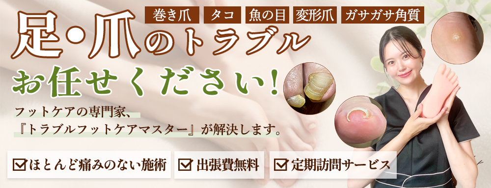足・爪のトラブルお任せください!