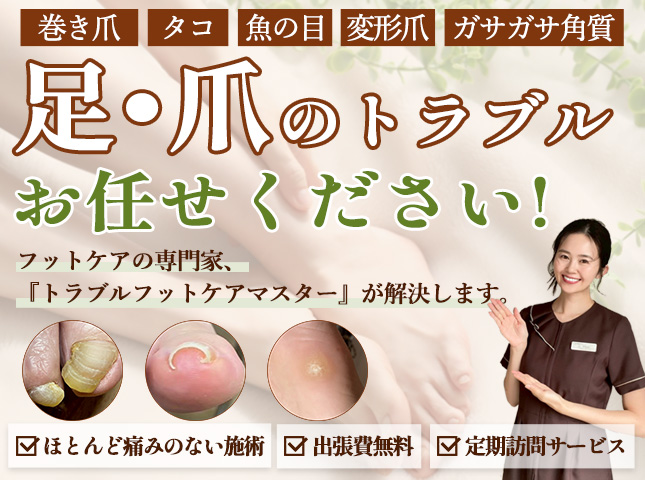 足・爪のトラブルお任せください!