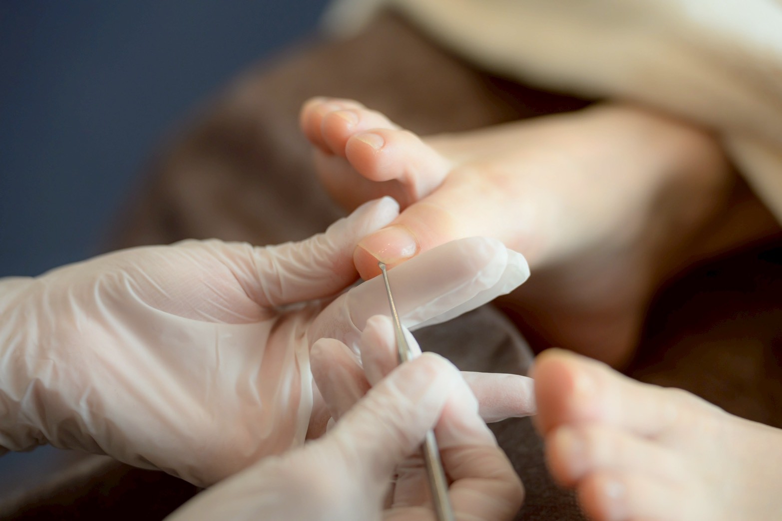 爪下の汚れ除去