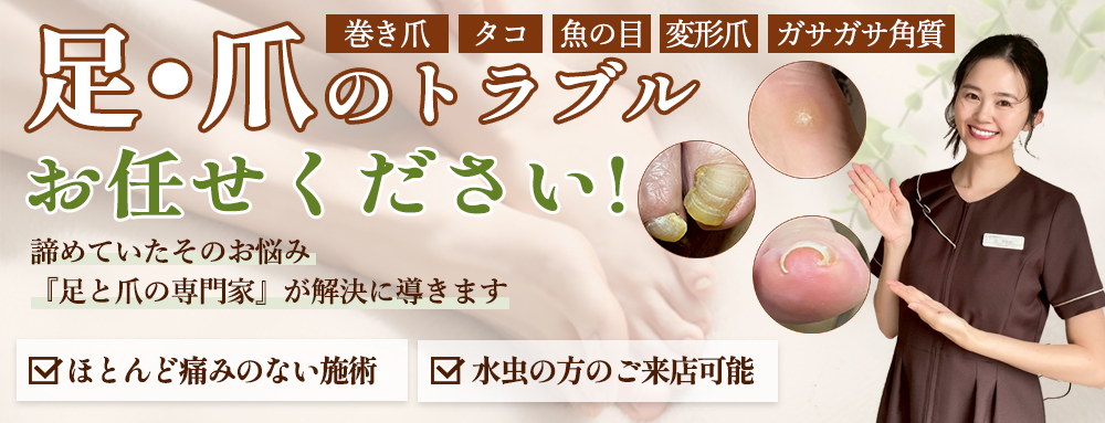 足・爪のトラブルお任せください！