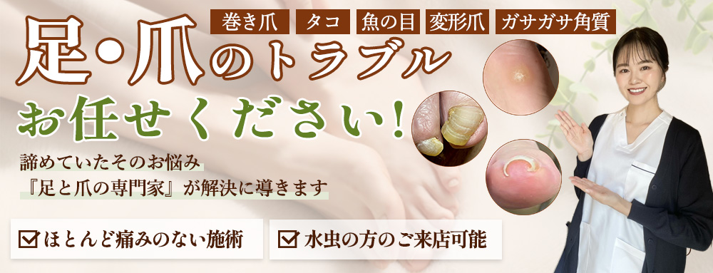 足・爪のトラブルお任せください！